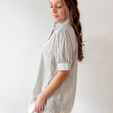 Stripe Dress with Lace Accent Detail Dress